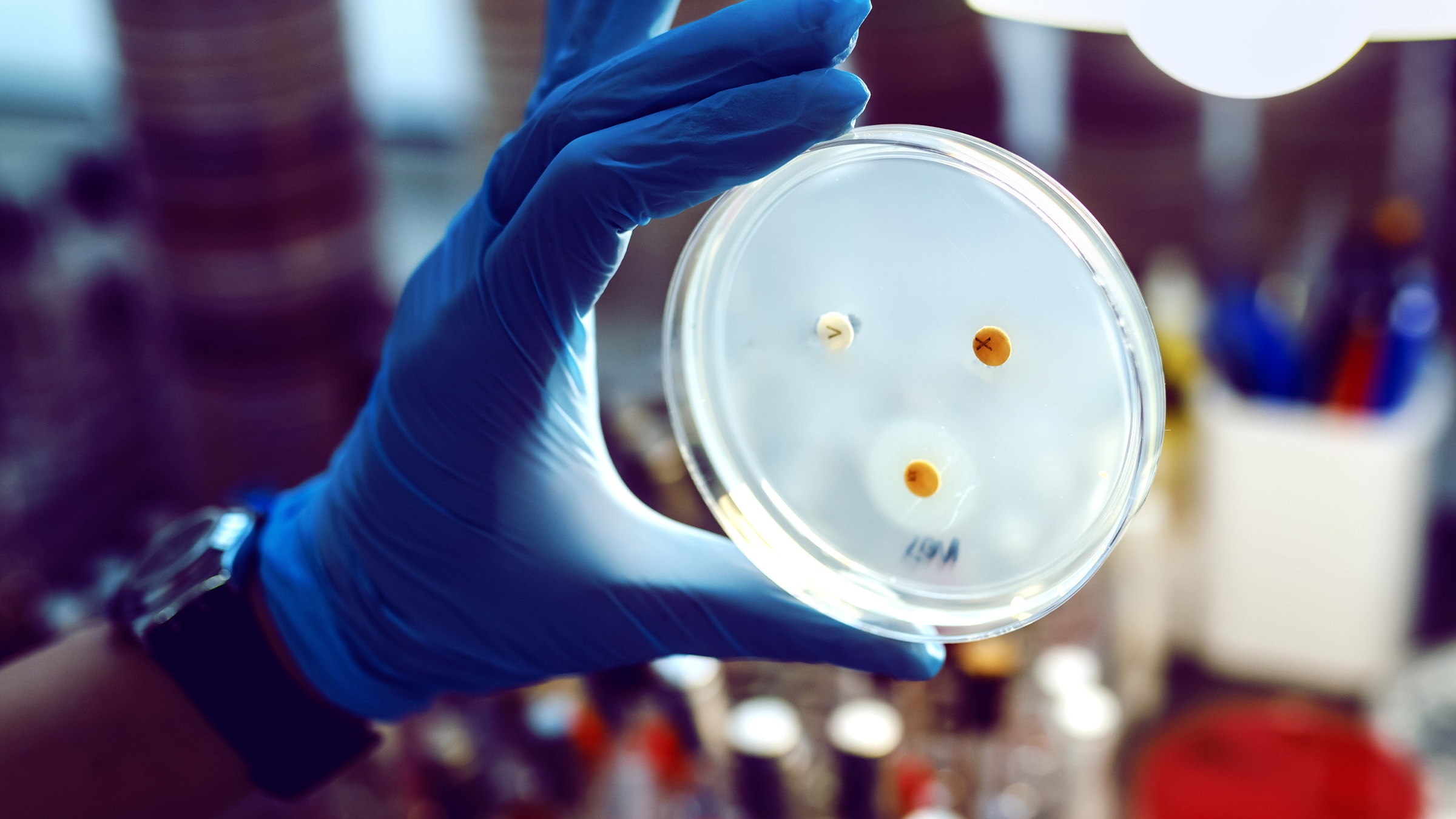 A person in the laboratory wearing blue gloves is holding a petri dish.